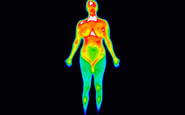 Термография: Эффективный метод диагностики рака груди и оценка рисков